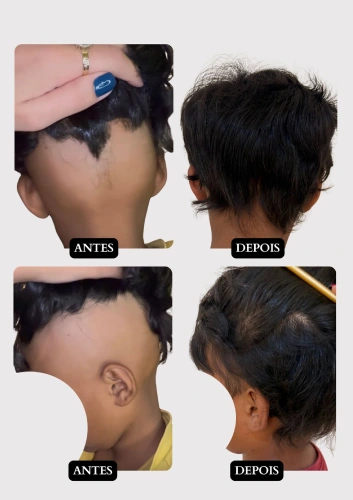 Resultado capilar 11