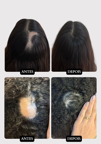 Resultado capilar 17