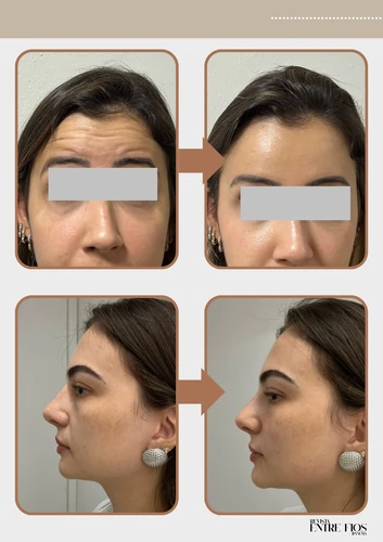 Resultado doença de pele 1