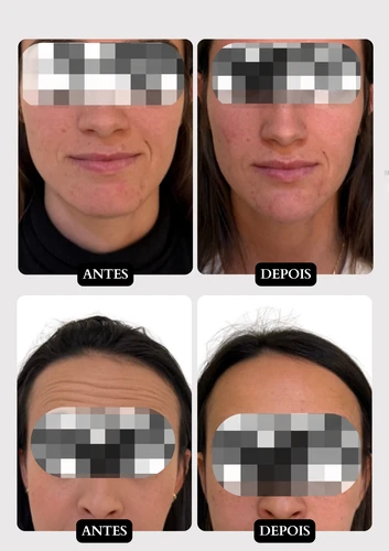 Resultado doença de pele 11