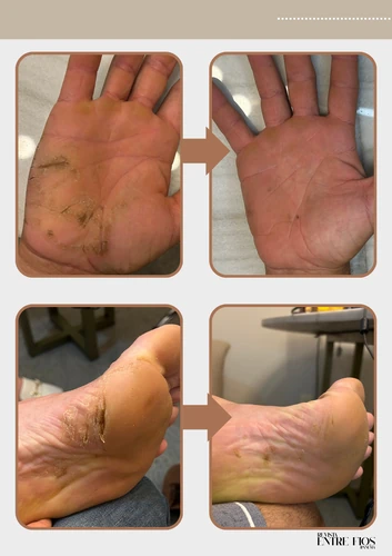 Resultado doença de pele 2