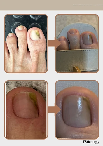 Resultado doença de pele 4