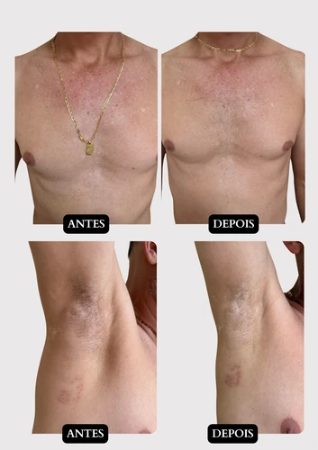 Resultado doença de pele 9